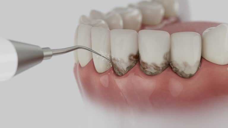Reliable Dental contractor in Zanesville, OH by Dentist Open Now